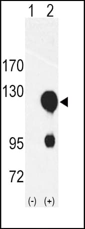 ROR2 Antibody (aa19-50)