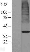 ACOT7 / BACH Protein (Over-Expression Lysate Myc-DDK (Flag))