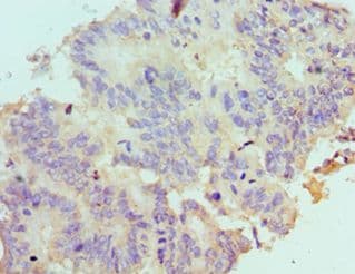 ARH / LDLRAP1 Antibody (aa59-308)