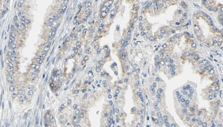 Polyclonal Rabbit anti-Human PH / PAH Antibody (IHC, IF, WB)