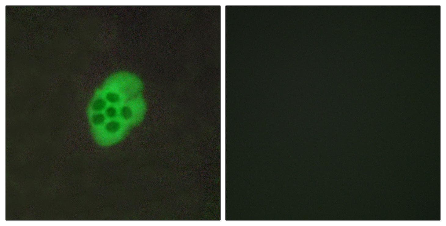 Polyclonal Rabbit anti-Human HTR4 / 5-HT4 Receptor Antibody (IF, WB)
