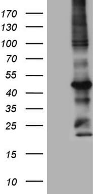 MTOR Antibody (aa1766-2144, clone OTI3E5)