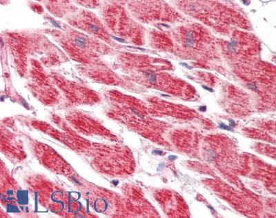 Polyclonal Rabbit anti-Human VPS37A Antibody (IHC, IF, WB)