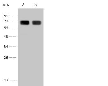 HPX / Hemopexin Antibody (clone 006, Preservative Free)