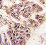 Polyclonal Rabbit anti-Human WDYHV1 Antibody (aa106-136, IHC, WB)