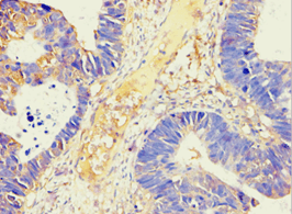 AMY2B Antibody (aa16-320)