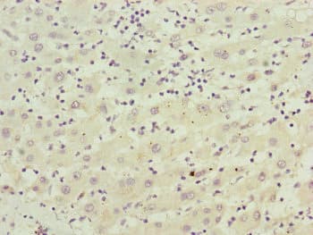 Polyclonal Rabbit anti-Human FBXO22 Antibody (IHC, WB)