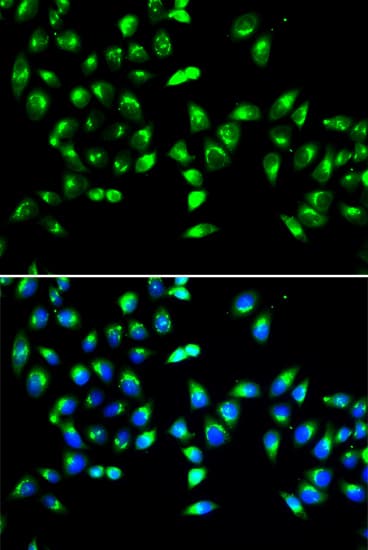 Polyclonal Rabbit anti-Human GALNT2 Antibody (IHC, IF, WB)