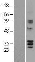 SIRT4 / Sirtuin 4 Protein (Over-Expression Lysate Myc-DDK (Flag))