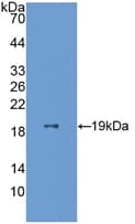 Human ESM1 / Endocan Protein (Recombinant His, N-Terminal)