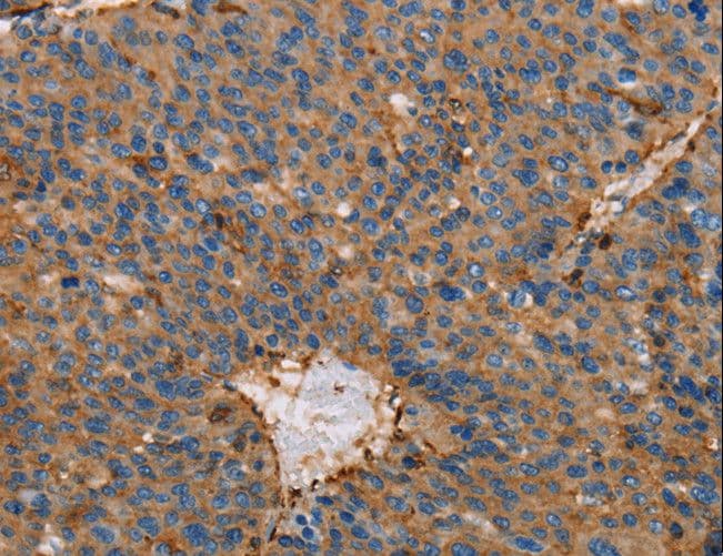 Polyclonal Rabbit anti-Human ACTA1 / Skeletal Muscle Actin Antibody (IHC, WB)