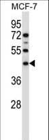Polyclonal Rabbit anti-Human SGMS1 / TMEM23 Antibody (aa24-53, IHC, WB)