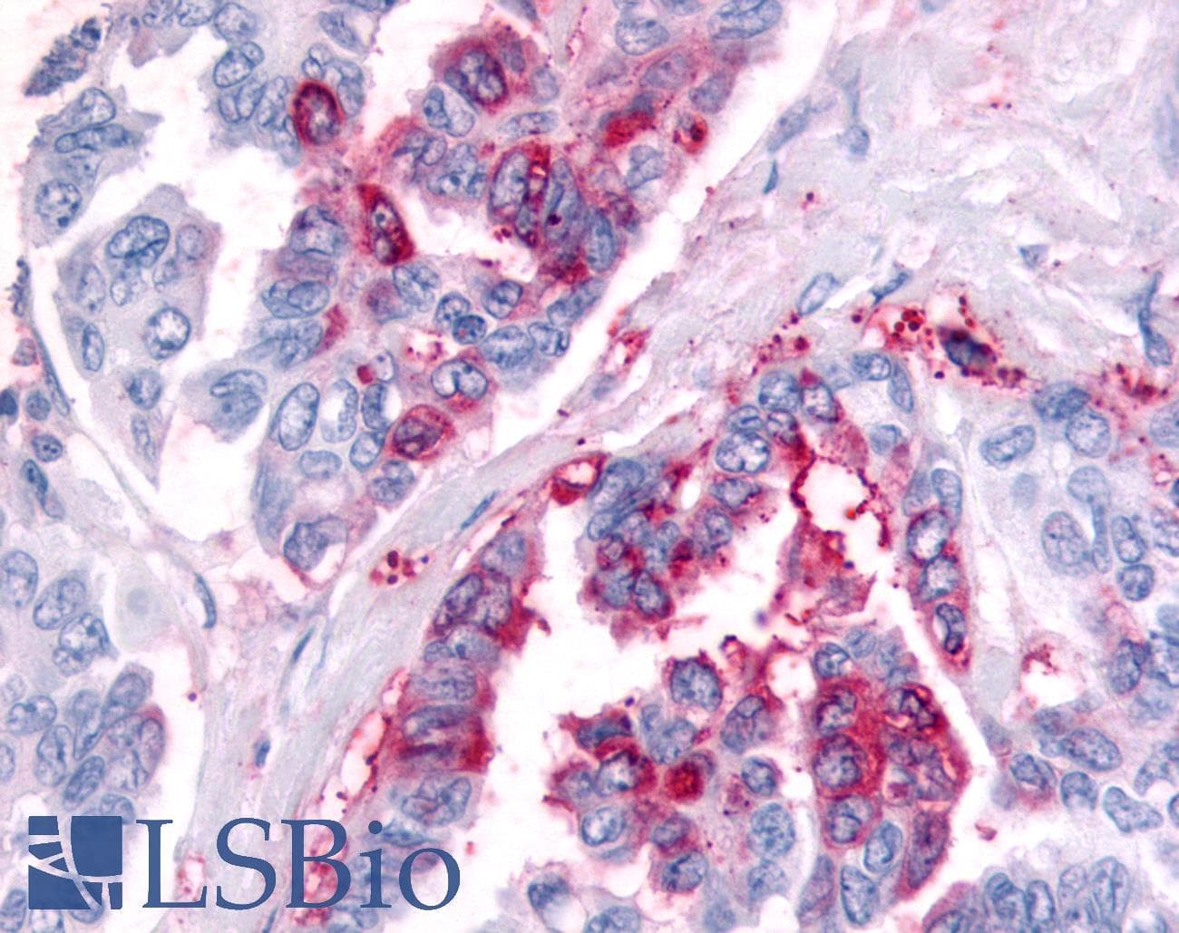 PathPlus™ Polyclonal Rabbit anti-Human PRKD2 / PKD2 Antibody (Internal, IHC)