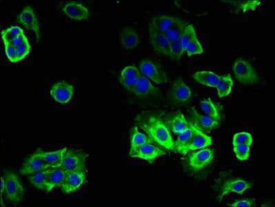 TRAM2 Antibody