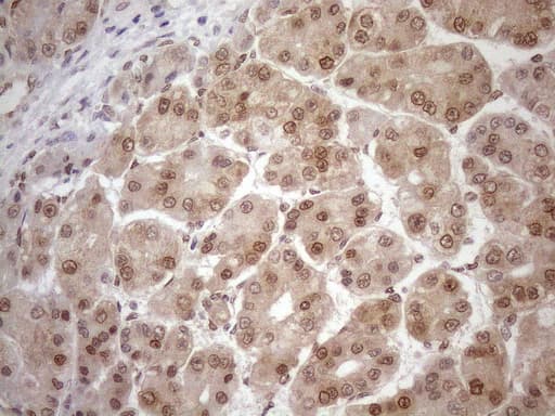 Monoclonal Mouse anti-Human MGMT Antibody (clone OTI2F10, IHC, WB)