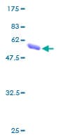 Human QDPR / DHPR Protein (Recombinant GST)