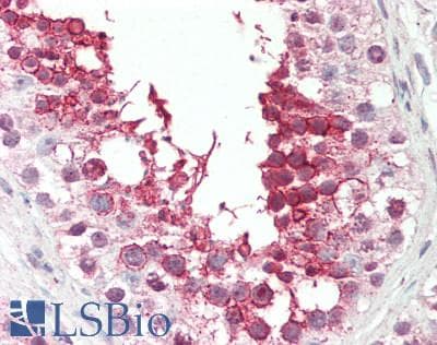 IHC-plus™ MLXIP / MONDOA Antibody