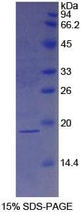 Rabbit IL1RN Protein (Recombinant His)