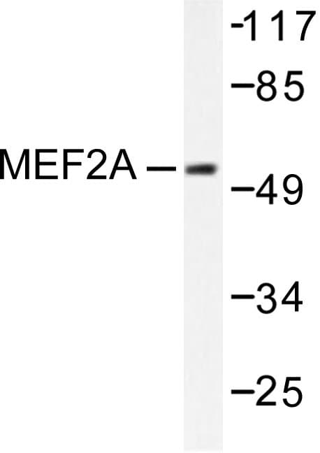 Polyclonal Rabbit anti-Human MEF2A / MEF2 Antibody (Ile402, IHC, IF, WB)