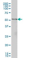 GPT / Alanine Transaminase Antibody (clone 1F10)