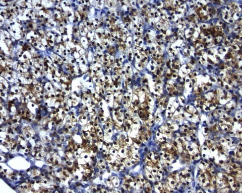 BCL2 / Bcl-2 Antibody (clone UMAB225)