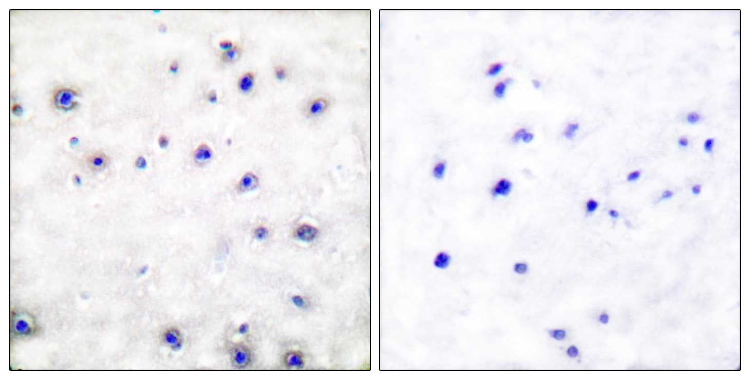 NTRK1 / TrkA Antibody (aa747-796)