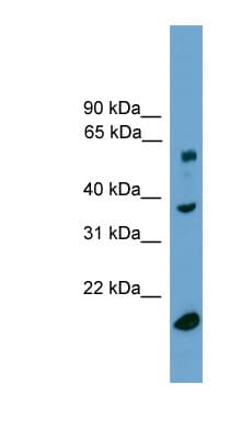 Polyclonal Rabbit anti-Human TBL1Y / TBL1 Antibody (C-Terminus, WB)