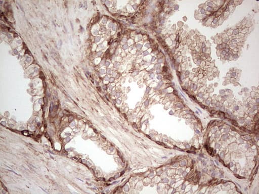 LGALS9 / Galectin 9 Antibody (clone OTI1D12)