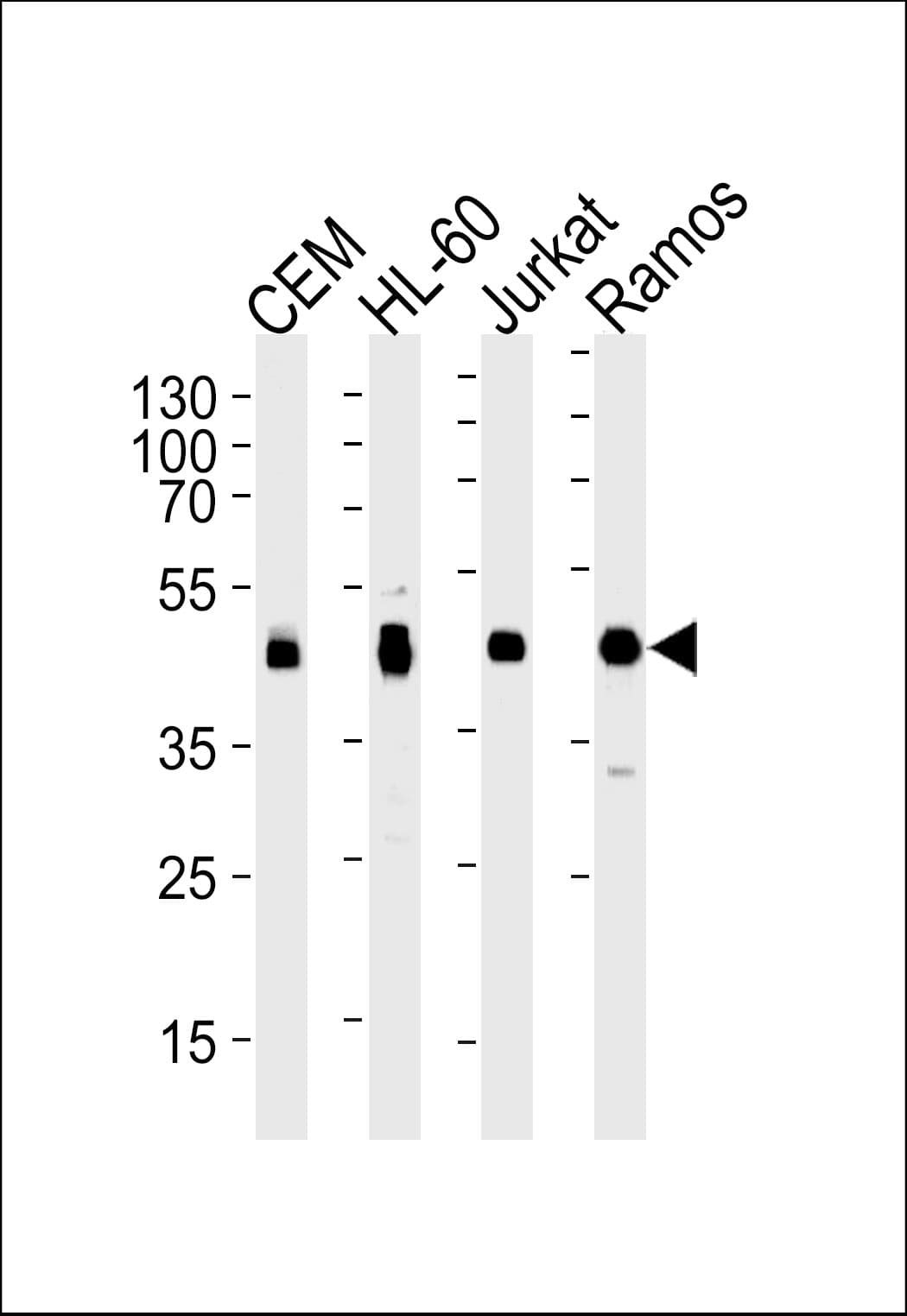 HLA-B Antibody (aa62-90)