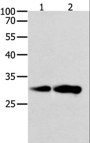 CAPNS1 / CAPN4 Antibody