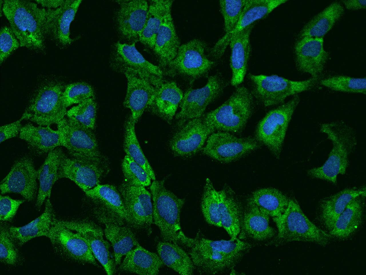 PUM2 Antibody
