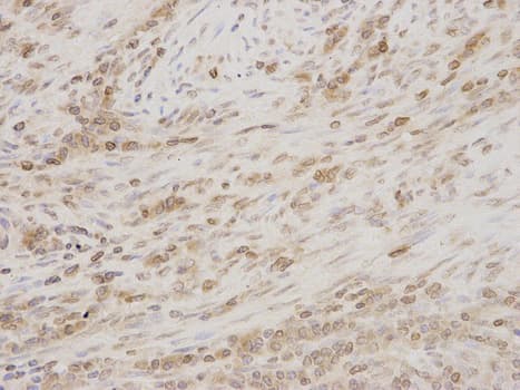 Polyclonal Rabbit anti-Human TMPO / TP / Thymopoietin Antibody (IHC, IF, WB)