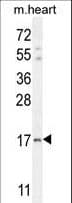 Polyclonal Rabbit anti-Human IER3 / IEX-1 Antibody (aa38-65, IHC, IF, WB)
