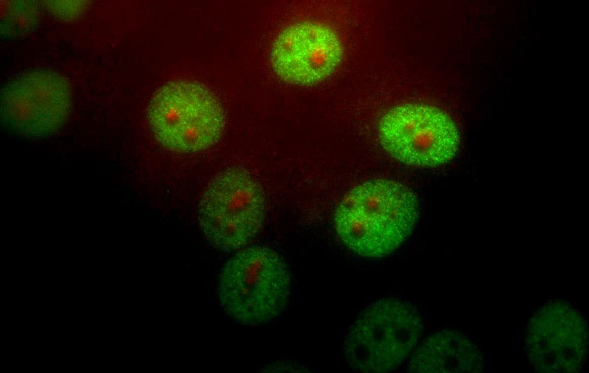 IHC-plus™ Polyclonal Chicken anti-Human PIN1 Antibody (IHC, IF, WB)