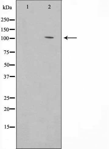 COL1A2 / Collagen I Alpha 2 Antibody
