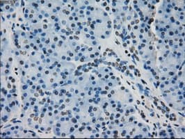 CRYAB / Alpha B Crystallin Antibody (clone OTI6A9)