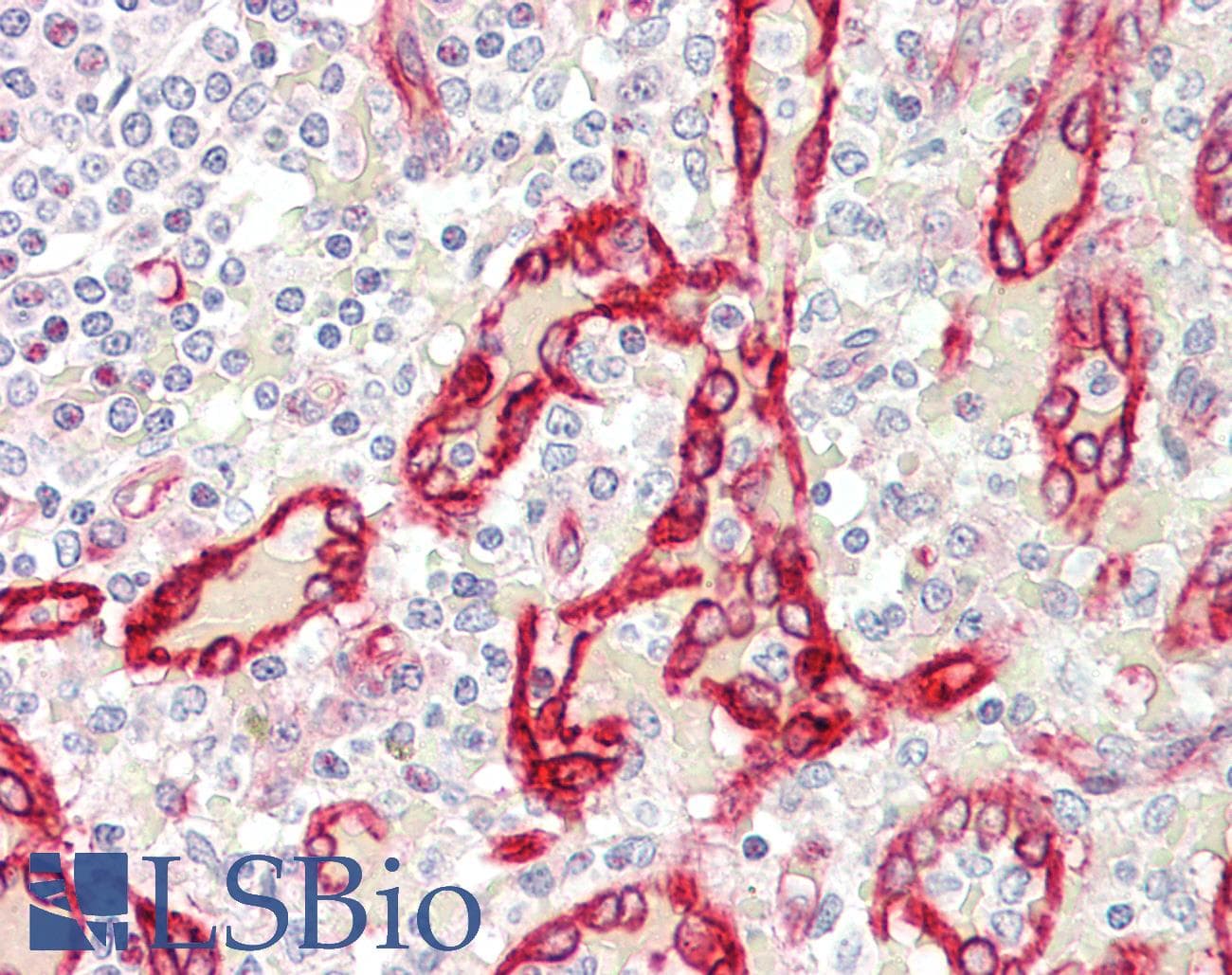 IHC-plus™ Polyclonal Rabbit anti-Human SDR / SDPR Antibody (C-Terminus, IHC, IF, WB)