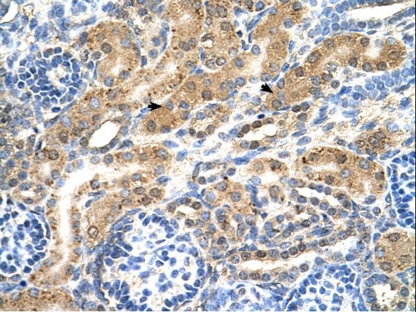 PTPN2 / TC-PTP Antibody (aa201-250)