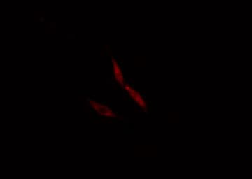 Polyclonal Rabbit anti-Human CNOT4 / CLONE243 Antibody (IHC, IF, WB)