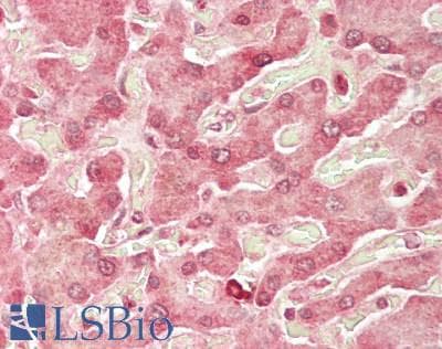 IHC-plus™ RPUSD3 Antibody
