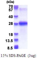 Human CHODL / Chondrolectin Protein (Recombinant His)