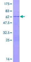 Human TRIM72 / MG53 Protein (Recombinant GST)