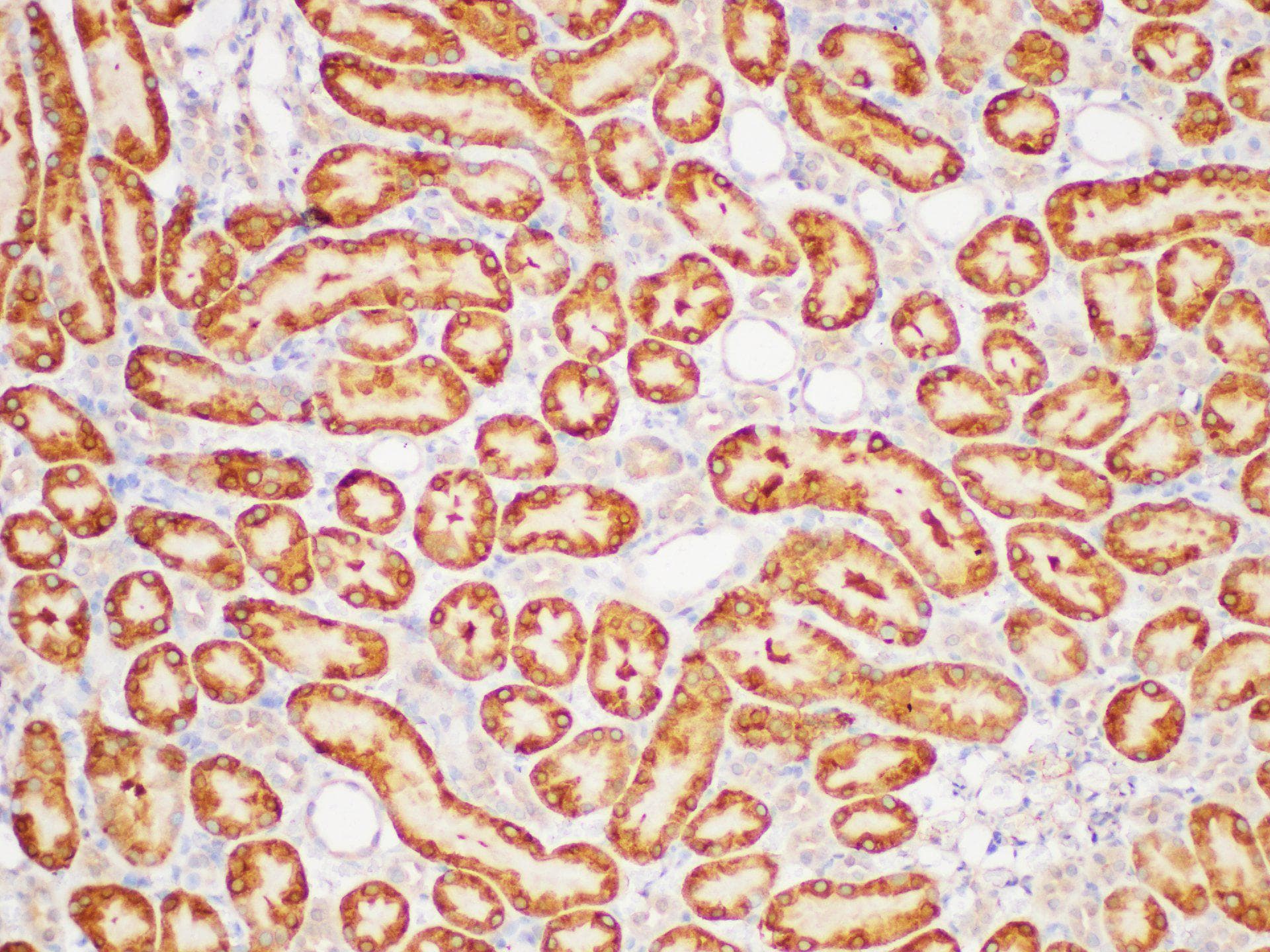 Polyclonal Rabbit anti-Mouse GSTP1 / GST Pi Antibody (IHC, WB)
