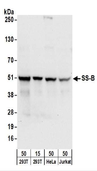 Polyclonal Rabbit anti-Human SSB / La Antibody (aa358-408, IHC, WB)