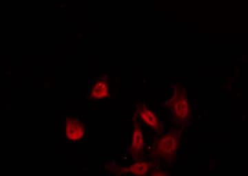 KCNIP3 / Dream / Calsenilin Antibody