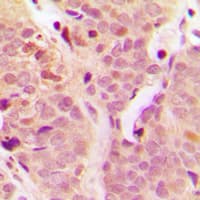 Polyclonal Rabbit anti-Human NFKB1 / NF-Kappa-B Antibody (C-Terminus, IHC, WB)