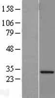 VAP33 / VAPA Protein (Over-Expression Lysate Myc-DDK (Flag))