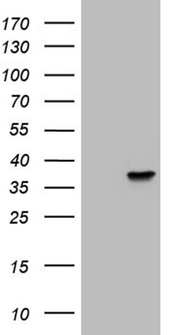 NKX3-1 Antibody (clone OTI4C11)