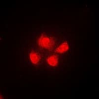 IHC-plus™ Polyclonal Rabbit anti-Human UBXD9 / ASPL Antibody (IHC, IF, WB)