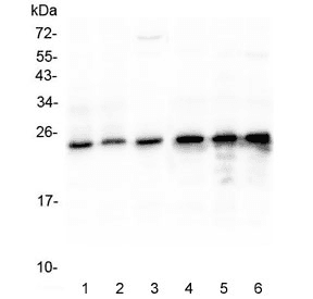 Polyclonal Rabbit anti-Human MtTFA / TFAM Antibody (IHC, WB)